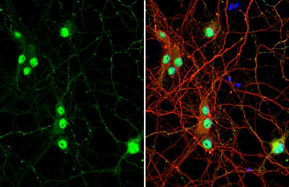 VGAT Antibody in Immunocytochemistry (ICC/IF)