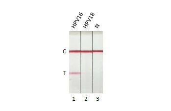 HPV Type 16 E7 Antibody in Lateral Flow (LF)