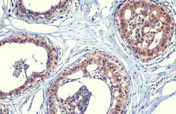 SOD1 Antibody in Immunohistochemistry (Paraffin) (IHC (P))