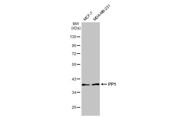 PP1 alpha/beta/gamma Antibody in Western Blot (WB)