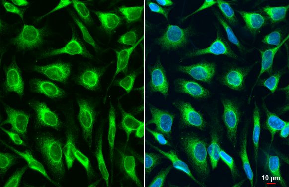 Lass2 Antibody in Immunocytochemistry (ICC/IF)