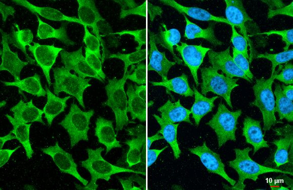 MUC2 Recombinant Rabbit Monoclonal Antibody (HL1724) | Invitrogen (MA5 ...
