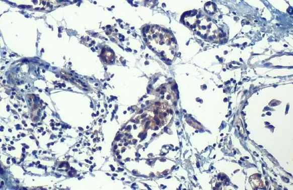 HHIP Antibody in Immunohistochemistry (Paraffin) (IHC (P))
