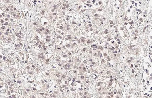 SESN1 Antibody in Immunohistochemistry (Paraffin) (IHC (P))