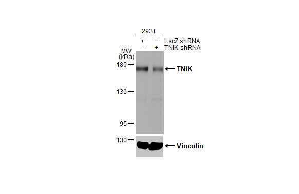 TNIK Antibody in Western Blot (WB)