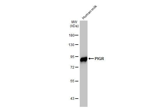 PIGR Antibody in Western Blot (WB)