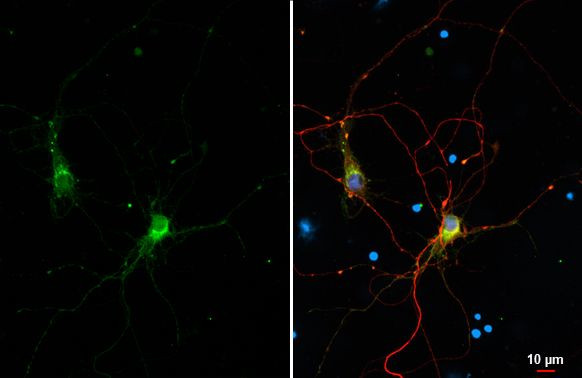 CD90 Antibody in Immunocytochemistry (ICC/IF)