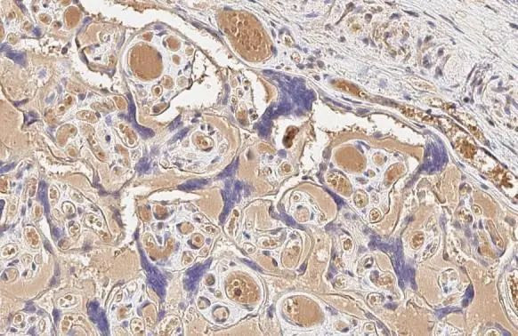 Mig-6 Antibody in Immunohistochemistry (Paraffin) (IHC (P))