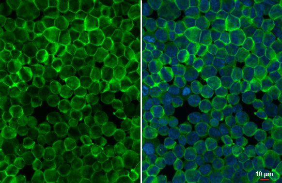 BTK Antibody in Immunocytochemistry (ICC/IF)