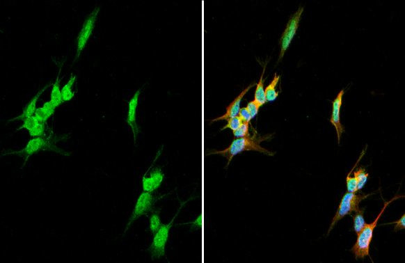 CaMKII Pan Antibody in Immunocytochemistry (ICC/IF)