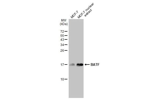 BATF Recombinant Monoclonal Antibody (HL1870) (MA5-47209)