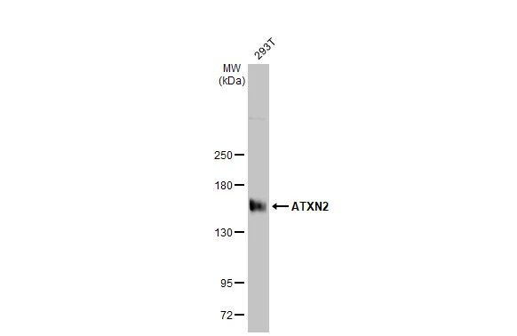 Ataxin 2 Antibody in Western Blot (WB)