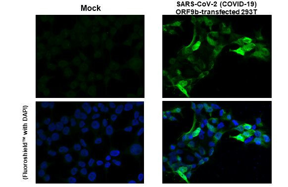 SARS-CoV-2 ORF9b Antibody in Immunocytochemistry (ICC/IF)