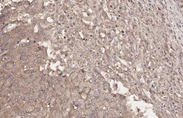 HHIP Antibody in Immunohistochemistry (Paraffin) (IHC (P))