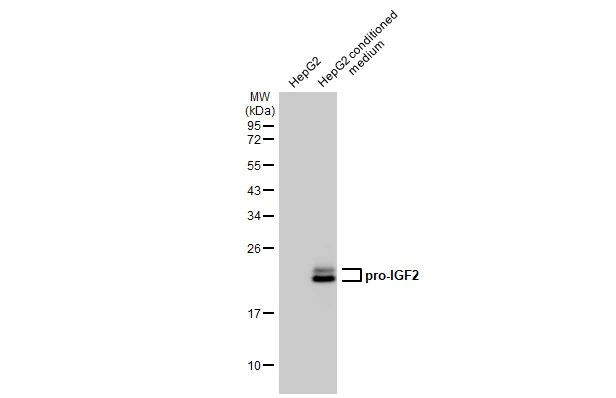 IGF2 Antibody in Western Blot (WB)