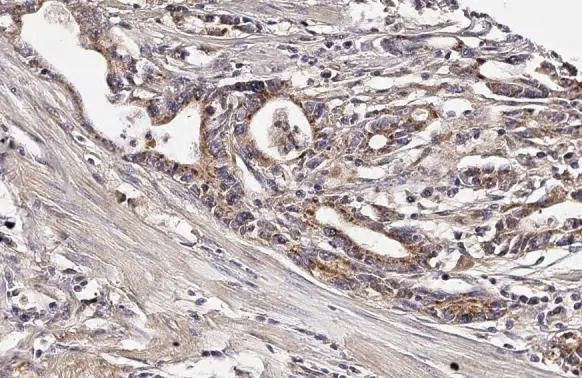 TFAM Antibody in Immunohistochemistry (Paraffin) (IHC (P))