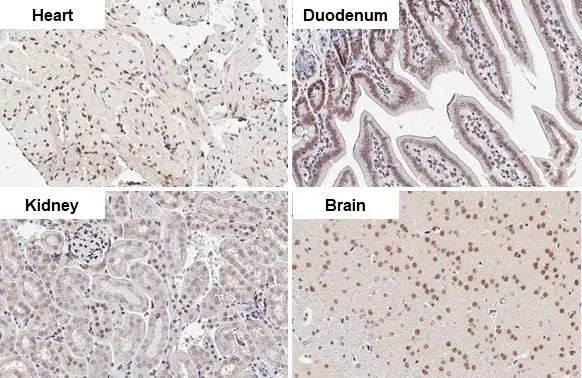CHD2 Antibody in Immunohistochemistry (Paraffin) (IHC (P))