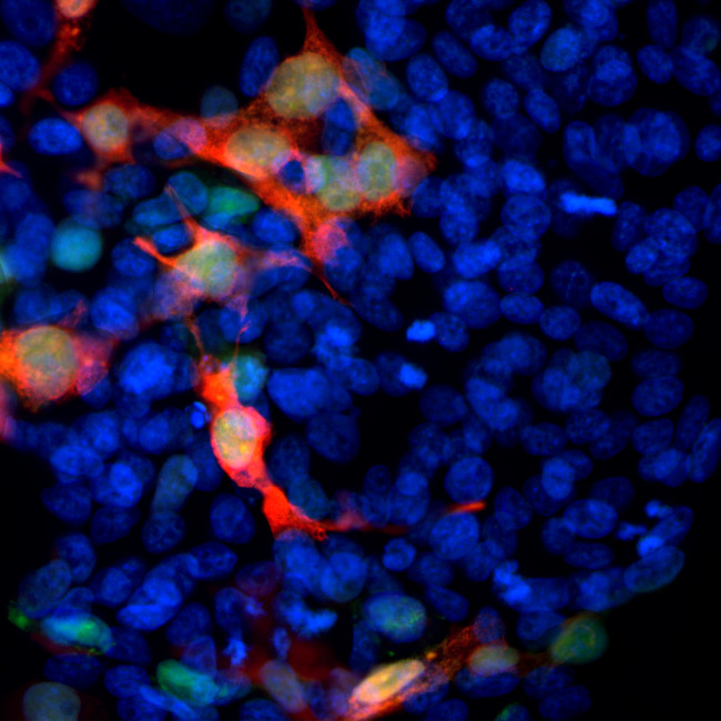 GFP Antibody in Immunocytochemistry (ICC/IF)