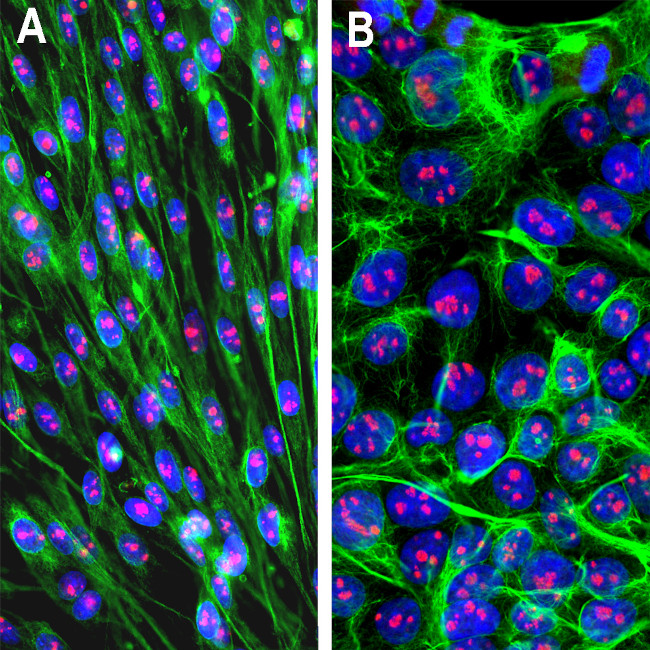Fibrillarin Antibody in Immunocytochemistry (ICC/IF)