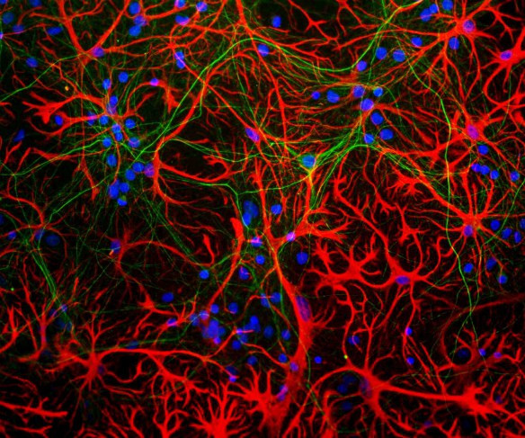 GFAP Antibody in Immunocytochemistry (ICC/IF)