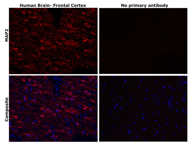 MAP2 Antibody in Immunohistochemistry (Paraffin) (IHC (P))