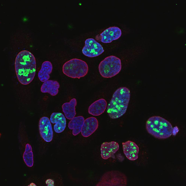 Ki-67 Antibody in Immunocytochemistry (ICC/IF)