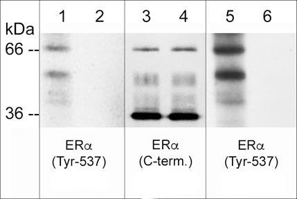 Phospho-Estrogen Receptor alpha (Tyr537) Antibody in Western Blot (WB)