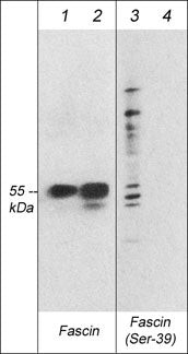 Phospho-Fascin (Ser39) Antibody in Western Blot (WB)
