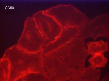 CD59 Antibody in Immunocytochemistry (ICC/IF)