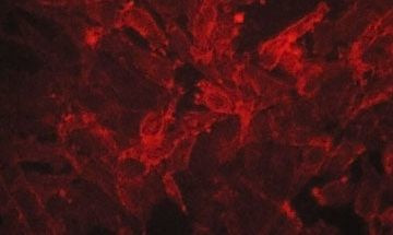 EphA2 Antibody in Immunocytochemistry (ICC/IF)