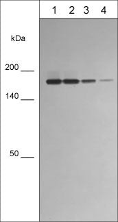 CD11a Antibody in Western Blot (WB)