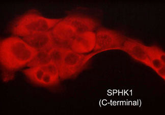SPHK1 Antibody in Immunocytochemistry (ICC/IF)