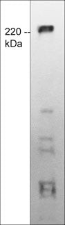 TRPM7 Antibody in Western Blot (WB)
