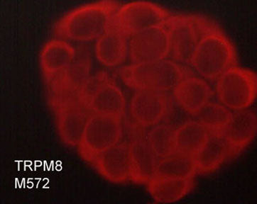 TRPM8 Antibody in Immunocytochemistry (ICC/IF)
