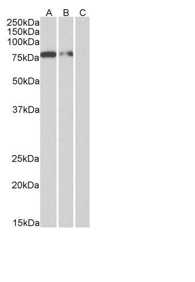 6x His Tag Chimeric Antibody in Western Blot (WB)