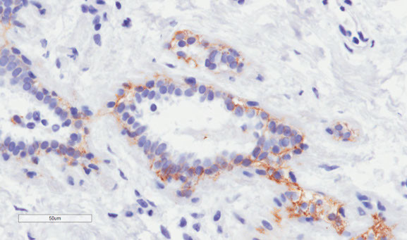 Trastuzumab Chimeric Antibody in Immunohistochemistry (Paraffin) (IHC (P))