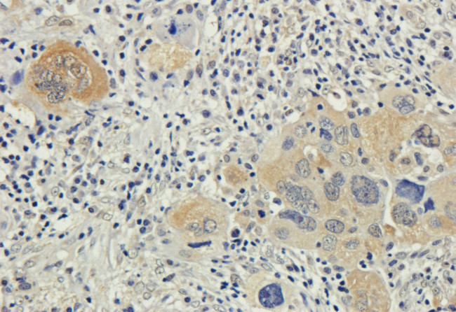 Bax Chimeric Antibody in Immunohistochemistry (PFA fixed) (IHC (PFA))