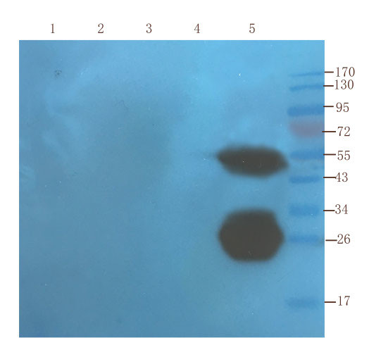 Infliximab Chimeric Antibody in Western Blot (WB)