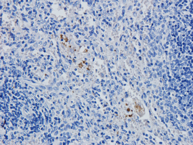 CD4 Antibody in Immunohistochemistry (Paraffin) (IHC (P))
