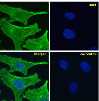 NOTCH2 Chimeric Antibody in Immunocytochemistry (ICC/IF)