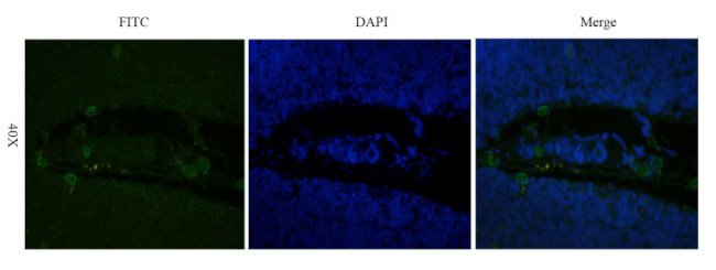 Basiliximab Chimeric Antibody in Immunohistochemistry (PFA fixed) (IHC (PFA))