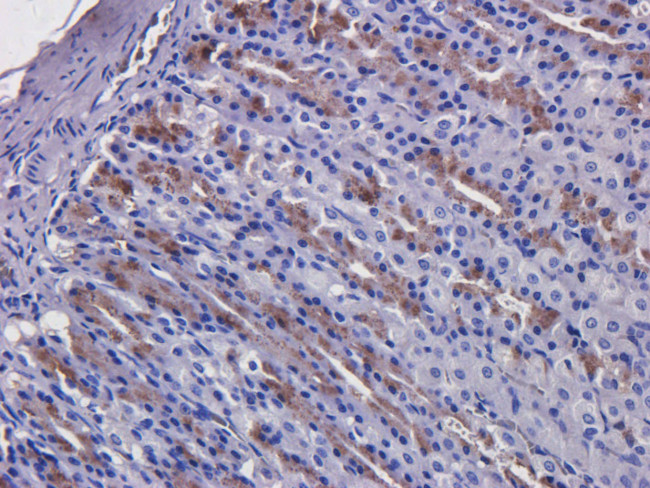 Cetuximab Antibody in Immunohistochemistry (Paraffin) (IHC (P))