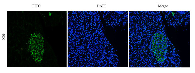 CD66e (CEACAM5) (Arcitumomab Biosimilar) Antibody in Immunohistochemistry (PFA fixed) (IHC (PFA))