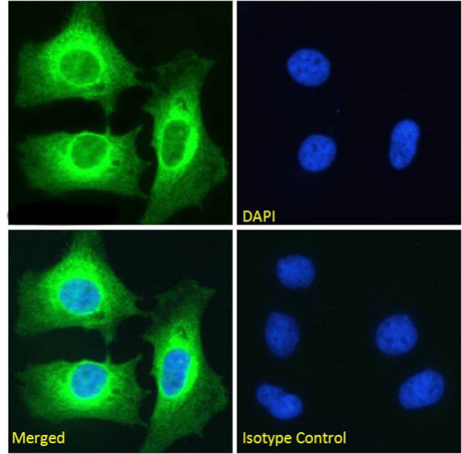 NFkB p100 Antibody in Immunocytochemistry (ICC/IF)