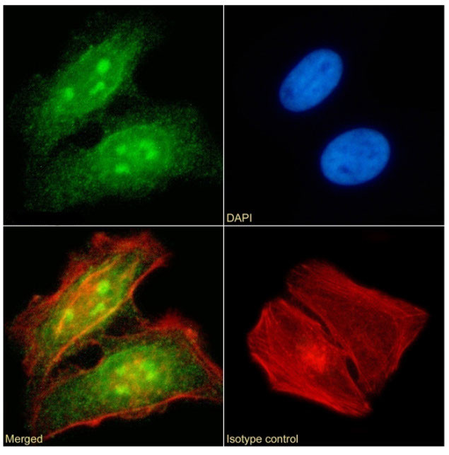 RAD23B Antibody in Immunocytochemistry (ICC/IF)
