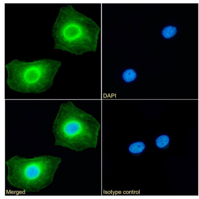 RRM2 Antibody in Immunocytochemistry (ICC/IF)