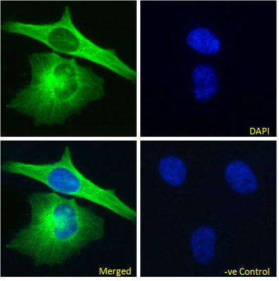 alpha Tubulin Chimeric Antibody in Immunocytochemistry (ICC/IF)