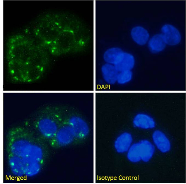 Glucagon Receptor Antibody in Immunocytochemistry (ICC/IF)