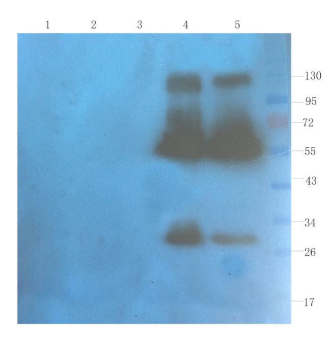 Ruplizumab Antibody in Western Blot (WB)