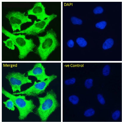 ITGA5/ITGB1 (Volociximab Biosimilar) Antibody in Immunocytochemistry (ICC/IF)